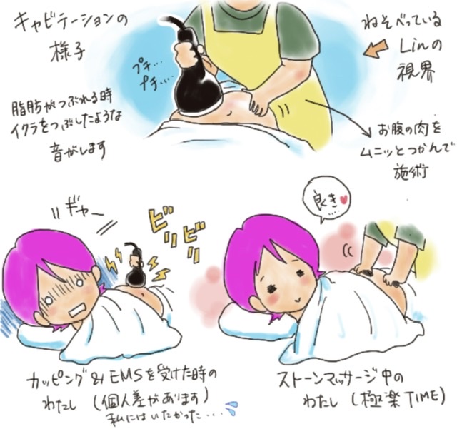 エステ体験記③「キャビテーション（脂肪溶解）をやってみた」