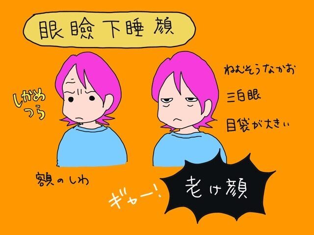 眼瞼下垂症オペを受けてみた！体験談